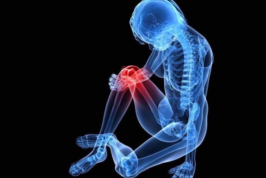 Arthrose