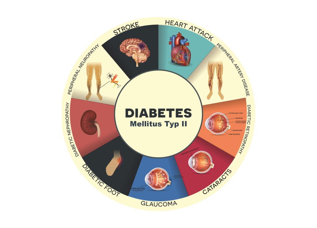 Typ-2-Diabetes mellitus: Ein umfassender Überblick