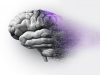 Ist Alzheimer dank neuer Therapie bald heilbar?