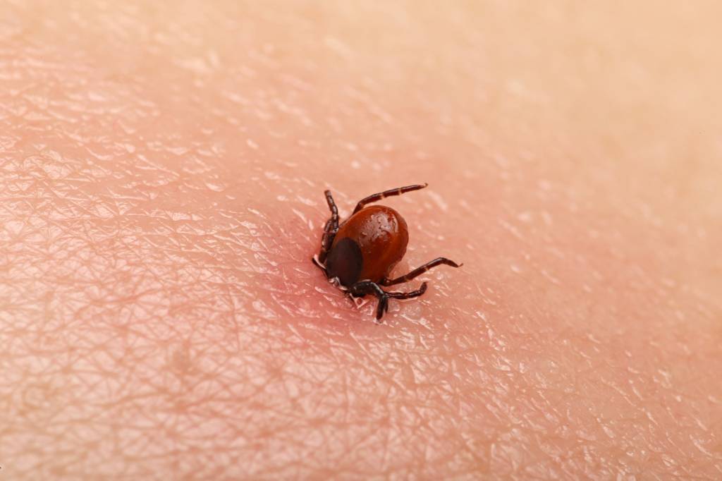 Verkannte Gefahr: Borreliose - Wie äußert sich Borreliose? - Wie ...