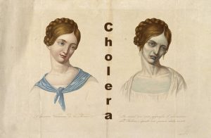 Cholera