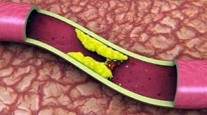 Triglyceride