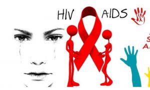 HIV AIDS